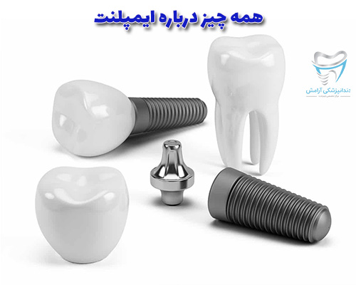لطفا با ما همراه باشید در مورد ایمپلنت دندان بیشتر آشنا شوید.