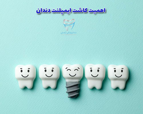 وقتی یک یا چند دندان خود را از دست می‌دهید جای خالی آنها به مرور بر روی حالت چهره شما تاثیر منفی میگذارد.