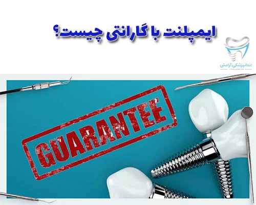 ضمانت ایمپلنت دندان بسته به نوع ایمپلنت میتواند شامل تعمیر یا تعویض ایمپلنت دندان باشد.