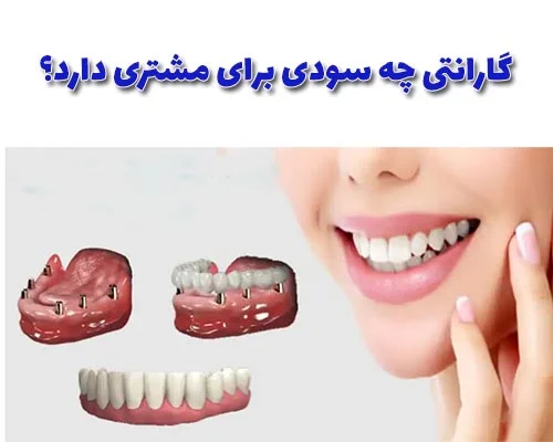 هر وسیله گرانبهایی که توسط یک شرکت بزرگ تولید میشود دارای ضمانت و گارانتی است که ایمپلنت دندان جز وسیله های گرانبها برای سلامت و زیبایی شما است.