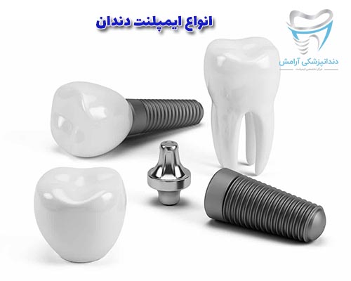 ایمپلنت های دندانی براساس پیچی بودن و یا تیغی شکل بودن با هم فرق میکنند.