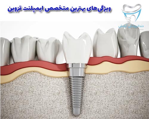 یک دندان پزشکی ایمپلنت دندان باید یک محیط آرام و تمیز داشته باشد.