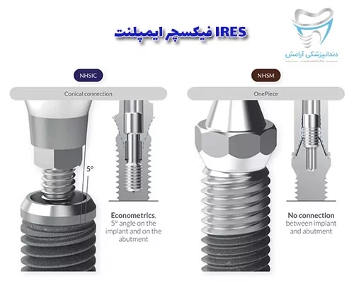 فیکسچر ایمپلنت IRES یکی از بهترین فیکسچر های جهان میباشد.