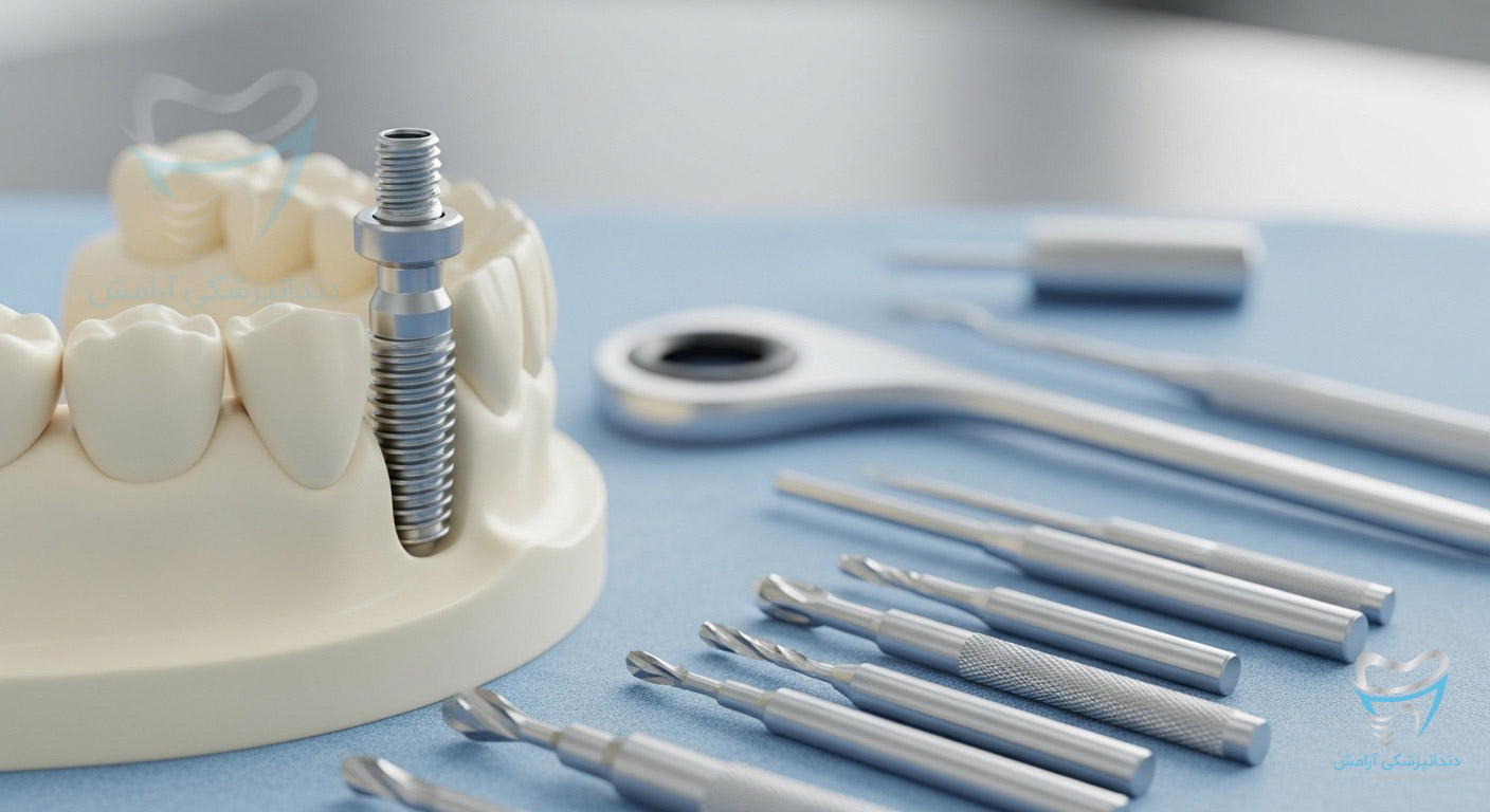 تصویر ایمپلنت دندان برای هدینگ هزینه ایمپلنت دندان عقل