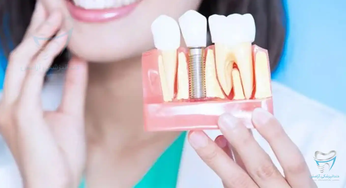دندانپزشک زنی در حال ایمپلنت دندان برای افراد دیابتی