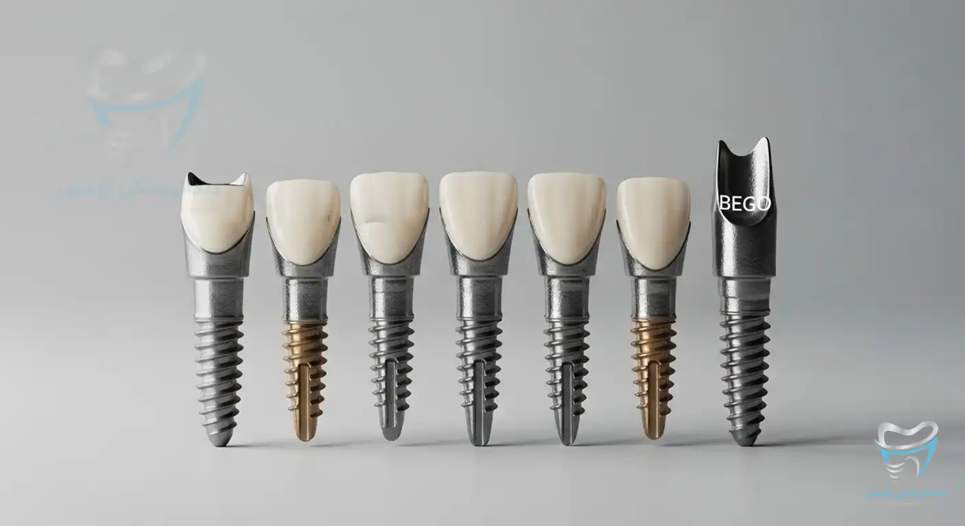 قیمت ایمپلنت بگو