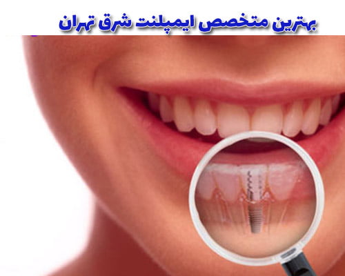 متخصص ایمپلنت شرق تهران