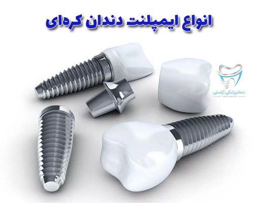 یکی از ایمپلنت هایی که در ایران چند سالی است که مورد استفاده بیشتر قرار گرفته است، ایمپلنت کره ای میباشد.