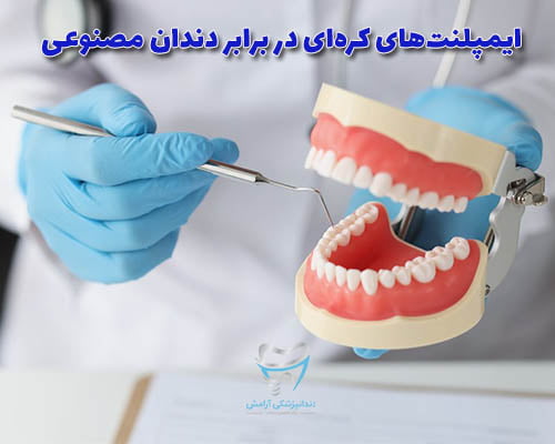 زمانی که قصد ندارید برای سلامت و زیبایی خود هزینه زیادی انجام دهید از دندان مصنوعی به جای ایمپلنت دندان استفاده کنید.