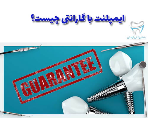 ضمانت ایمپلنت دندان بسته به نوع ایمپلنت می‌تواند شامل تعمیر یا تعویض ایمپلنت دندان باشد.