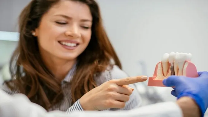 بررسی ویژگی های ایمپلنت بگو | ویژگی های ایمپلنت بگو آلمان