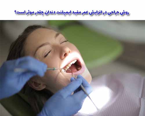 عمر ایمپلنت دندان پس از عمل جراحی، نقش بسیار مهمی بر عهده‌ی بیمار خود است.