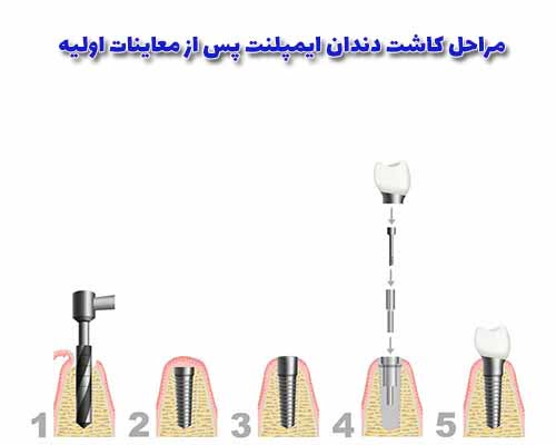 با استفاده از تصاویر پانورامیک، تخصصی و ممکن است سی‌تی اسکن نیز نیاز باشد