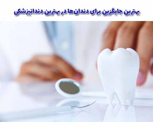 بهترین جایگزین برای دندان‌ها، ایمپلنت‌های دندانی با دقت واقعیت طبیعی و عملکرد بیشتر هستند.