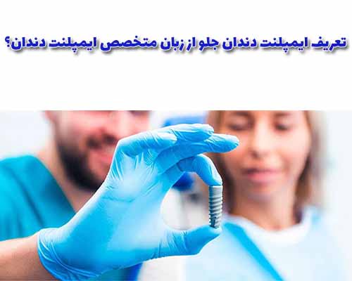 ایمپلنت دندان جلو (یا ایمپلنت دندان تکی) از دیدگاه متخصص ایمپلنت دندان یک روش جراحی پیشرفته در زمینه اندودنتیکس (علم دندانپزشکی ترمیمی) است.