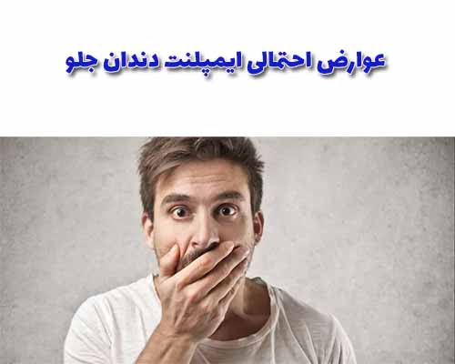 ایمپلنت دندان جلو، مثل سایر ایمپلنت‌ها، ممکن است با عوارض و مشکلاتی روبرو شود