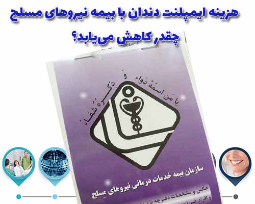 هزینه ایمپلنت دندان با دفترچه نیروهای مسلح