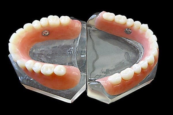 دندان مصنوعی سنتی