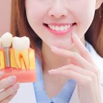 سن مناسب ایمپلنت دندان