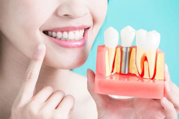 ایمپلنت دندان بدون درد