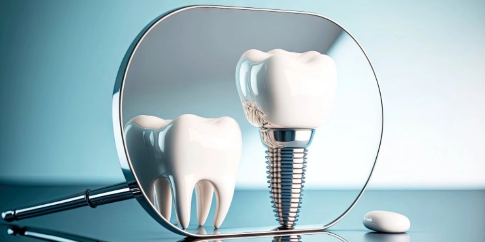 بهترین روش پیشگیری از عفونت ایمپلنت دندان