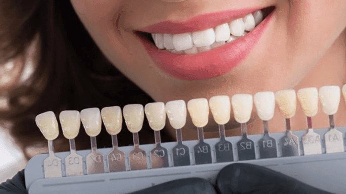 تفاوت کامپوزیت و لمینت