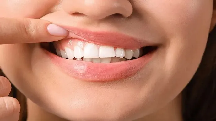 جراحی لثه چیست؟