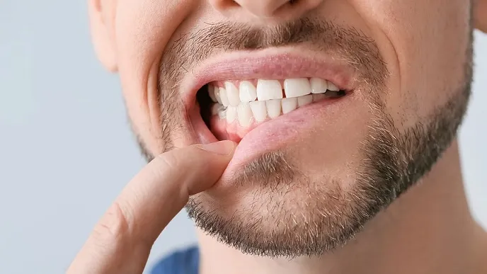 انواع پوسیدگی دندان | پوسیدگی دندان و عوارض آن