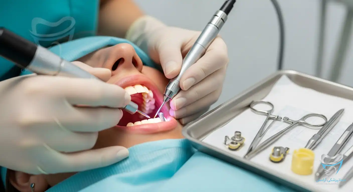 تصویری برای سوال کاشت ایمپلنت با لیزر چگونه است