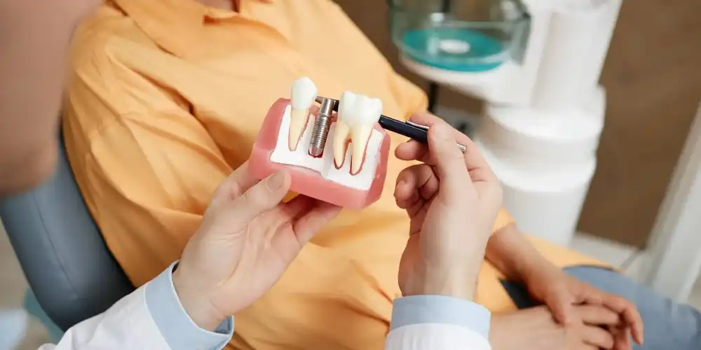 تصویر ایمپلنت دندان چقدر عمر میکند