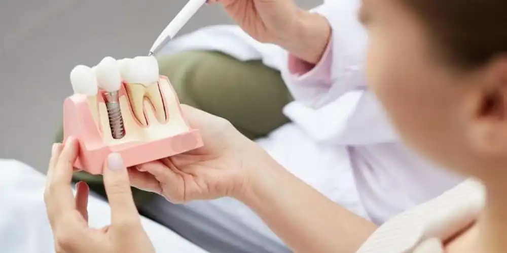 پاسخ سوال سخت ترین مرحله ایمپلنت کدام است؟