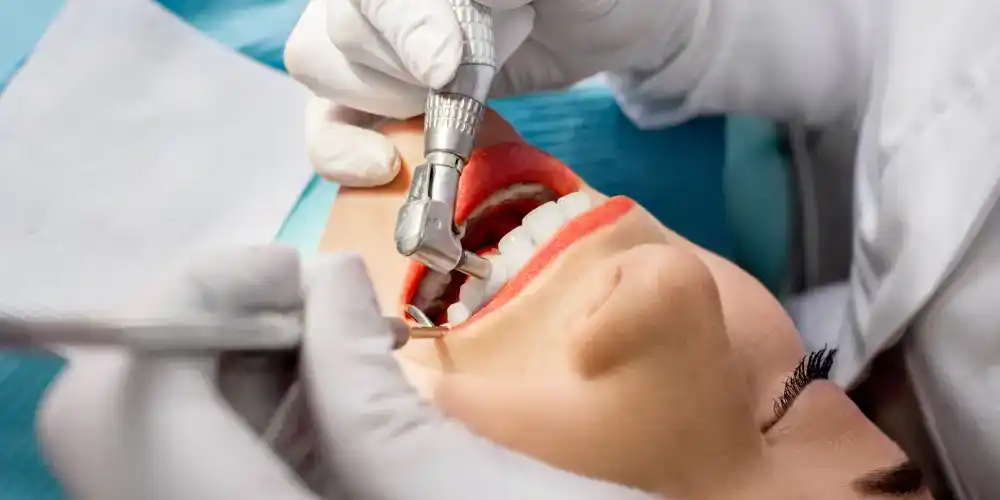 نکات هیلینگ دندان