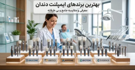 بهترین برند ایمپلنت دندان کدام است؟ راهنمای کامل انتخاب