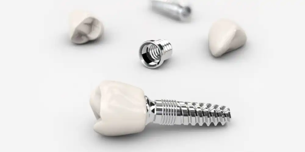 بررسی علل باز شدن هیلینگ ایمپلنت