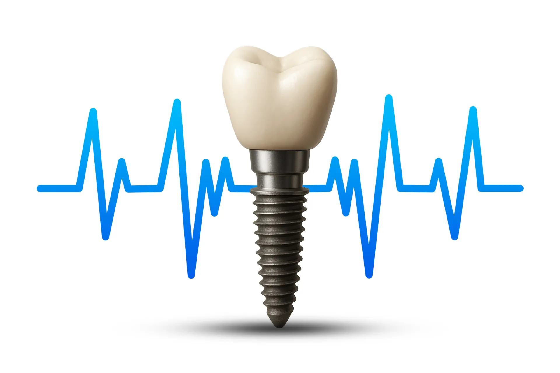 شرایط ایمپلنت دندان برای بیماران قلبی