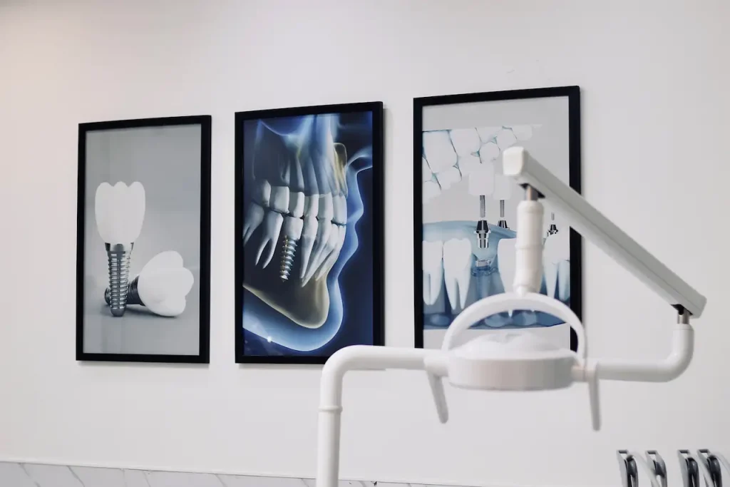 بررسی هزینه ایمپلنت دندان