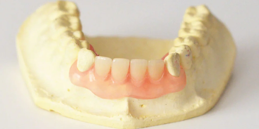 آشنایی با مراحل فلیپر دندان