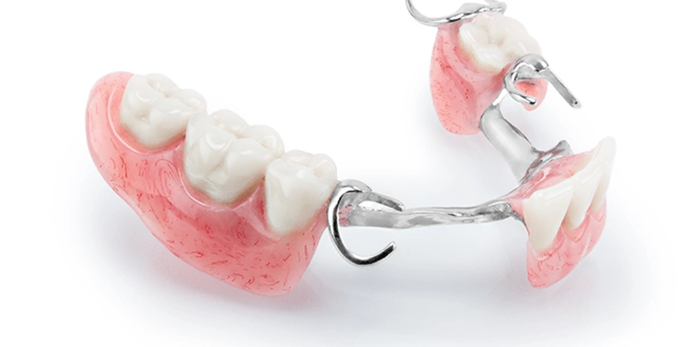 بررسی انواع فلیپر دندان