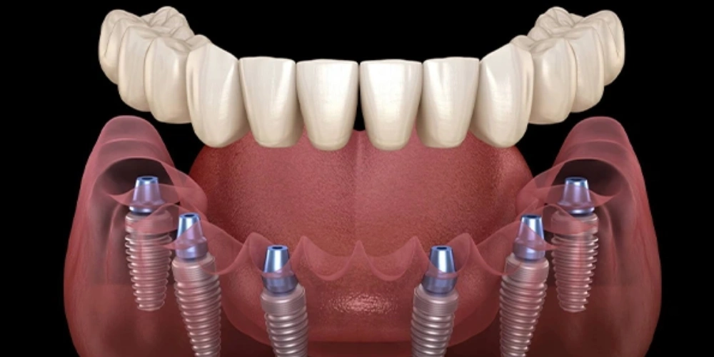 عدم استئواینتگریشن