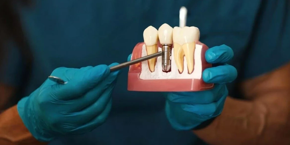 استئواینتگریشن چیست؟