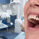 ایمپلنت BIOTEM برای چه کسانی مناسب است؟