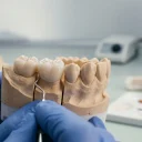 نیاز به سینوس لیفت